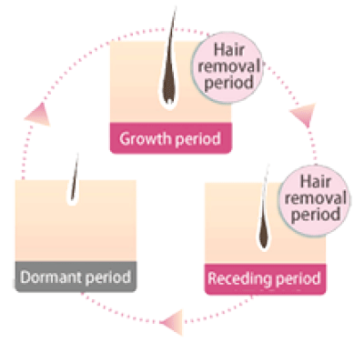 About how Gentle PRO hair removal works