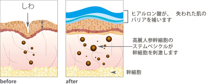 しわ改善と美白効果