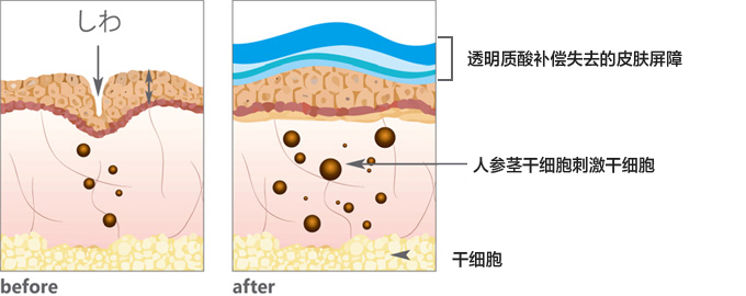 しわ改善と美白効果