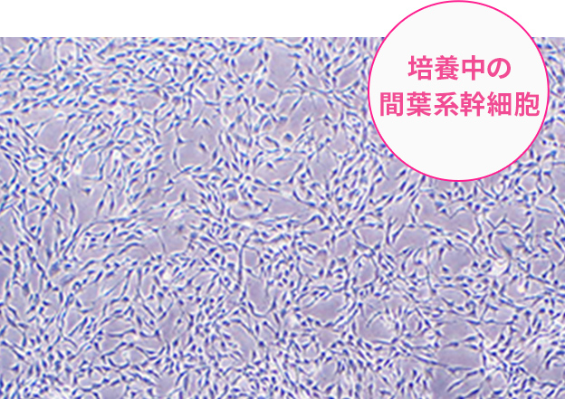 培養中の間葉系幹細胞